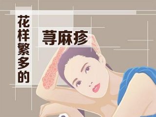 季节性荨麻疹平时要注意什么