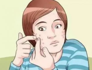 青春痘到底要不要挤
